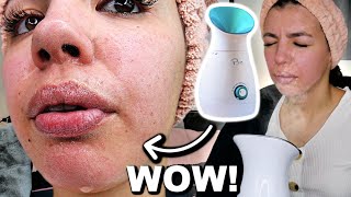 I Tested The Best FACIAL STEAMER On Amazon [upl. by Adnawuj]