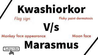 kwashiorkor marasmus Difference between kwashiorkor and marasmus [upl. by Lahcear]