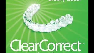 Clear Aligner Treatment with ClearCorrect™ [upl. by Mirth]