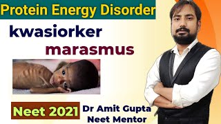 kwashiorkor and marasmus disease in hindi  protein energy malnutrition disorder  neet 2025 biology [upl. by Hgiel]