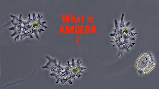 What is Amoeba [upl. by Llerrud849]