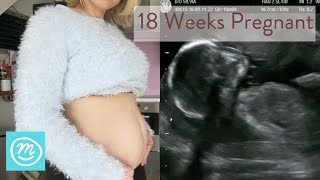 18 Weeks Pregnant What You Need To Know  Channel Mum [upl. by Siegel]