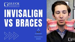 Invisalign vs Braces Tips from a Board Certified Orthodontist [upl. by Elohcan]