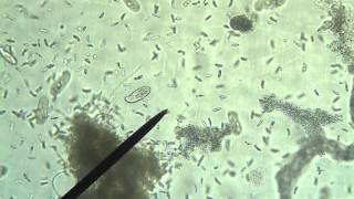 Protists Amoeba Euglena Paramecium [upl. by Selry]