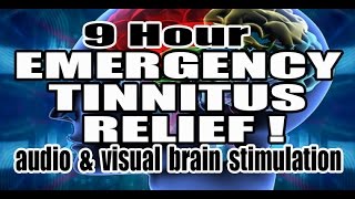 TINNITUS RELIEF Violet Noise  Neuromodulation  Visual Stimulus [upl. by Raines]