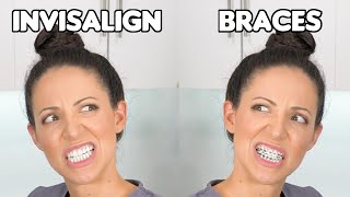 Braces or Invisalign Which is BETTER [upl. by Regdirb]