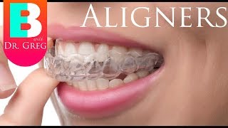 Things to Know Before Invisalign  Clear Aligner Therapy [upl. by Annmarie50]