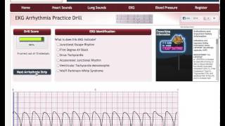 Easy EKG Rhythm Interpretation Part 2 [upl. by Nybor]