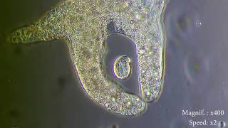 Amoeba eats paramecia  Amoebas lunch   Amoeba Endocytosis  Phagocytosis Part 1  👌 [upl. by Liponis]