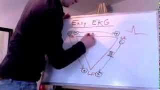 Easy EKG Einthovens Triangle [upl. by Teri699]