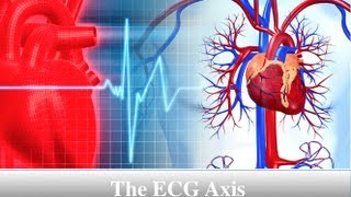 ECG Axis Tutorial Part 1  Einthovens Triangle [upl. by German]