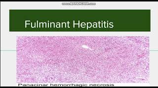 Fulminant Hepatitis Introduction Causes and Morphology [upl. by Atyekram]