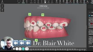 The Invisalign® ClinCheck Process [upl. by Etnor]