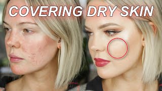 EXTREMELY DRY SKIN FOUNDATION ROUTINE surprising makeup tips for dry and sensitive skin [upl. by Garek]