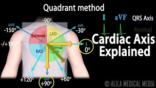 Cardiac Axis Interpretation Animation [upl. by Enilehcim]