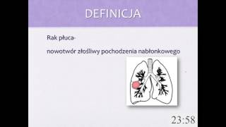 Kiedy podejrzewać raka płuc [upl. by Novj186]